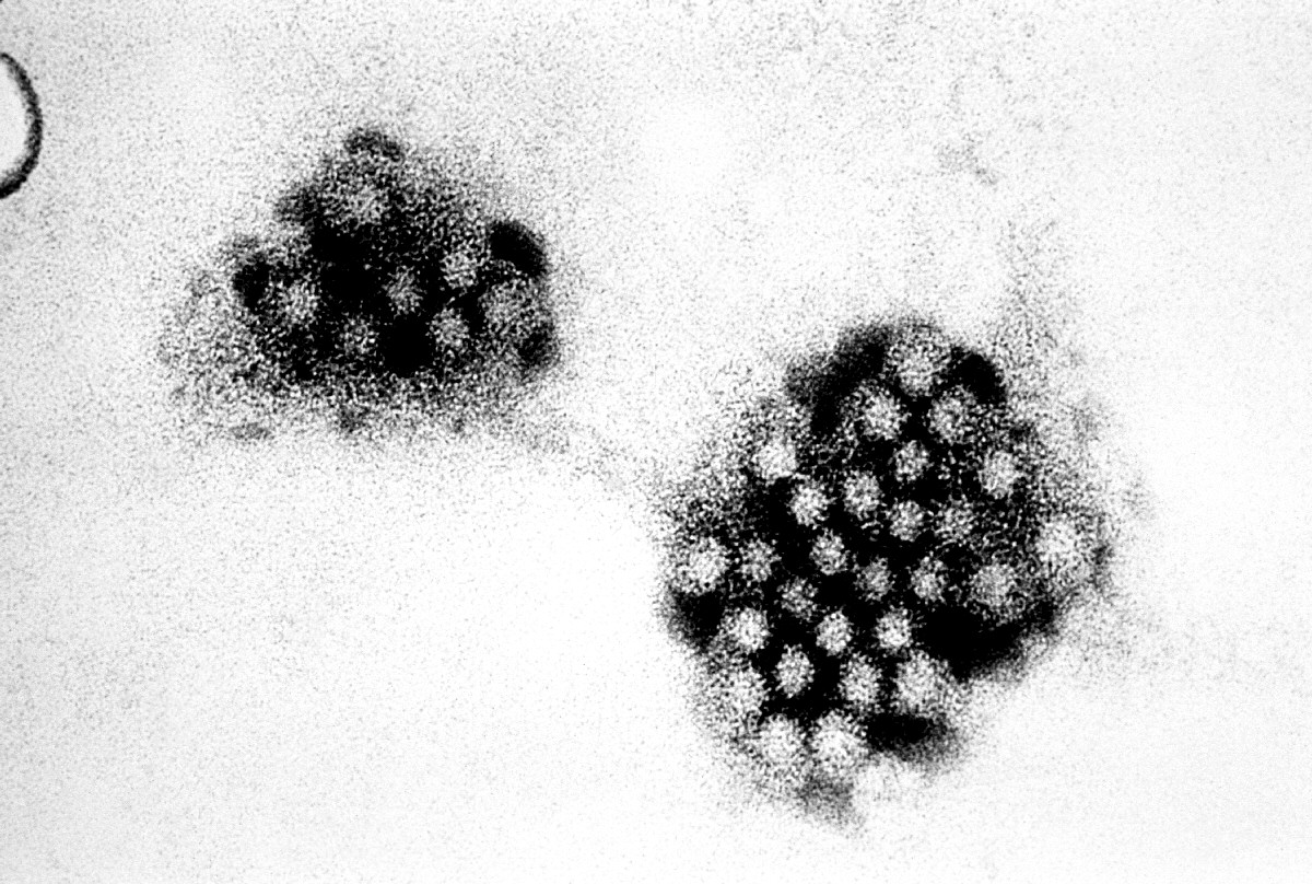 Photo by E L Palmer USCDCP on Pixnio - electron micrograph - norovirus - 32nm - sized - viral - particles